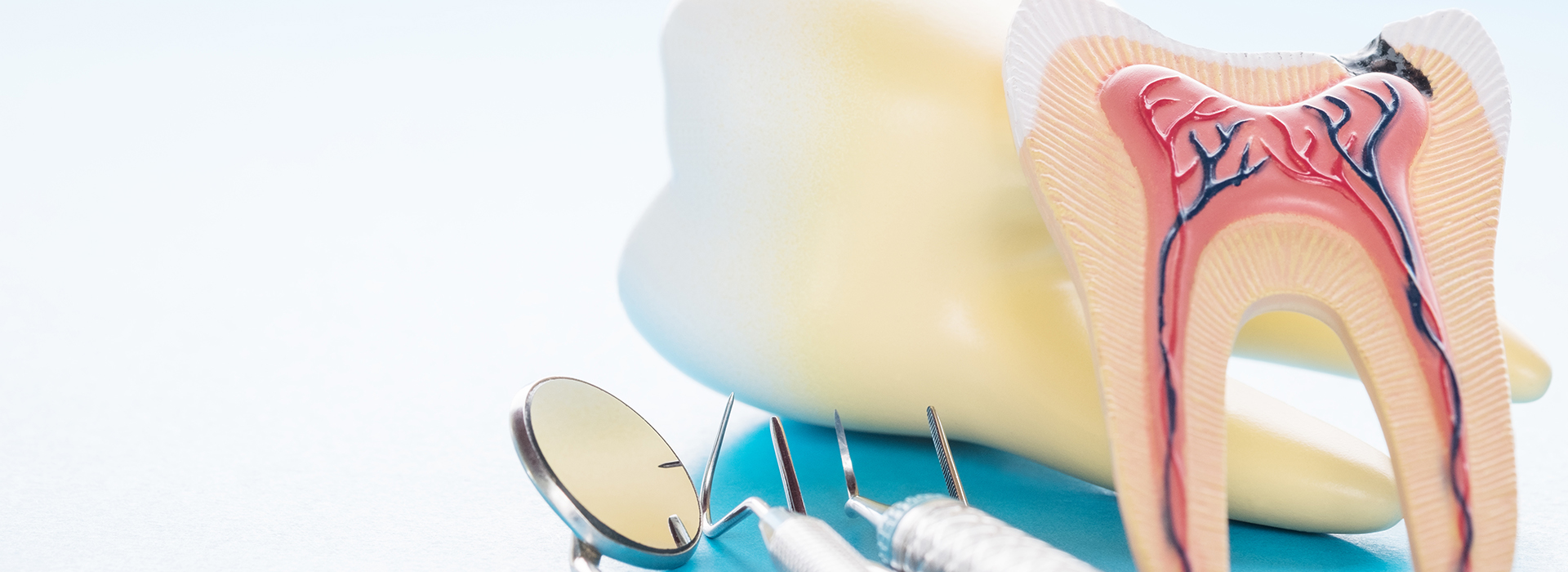 Hyattsville Root Canal Therapy